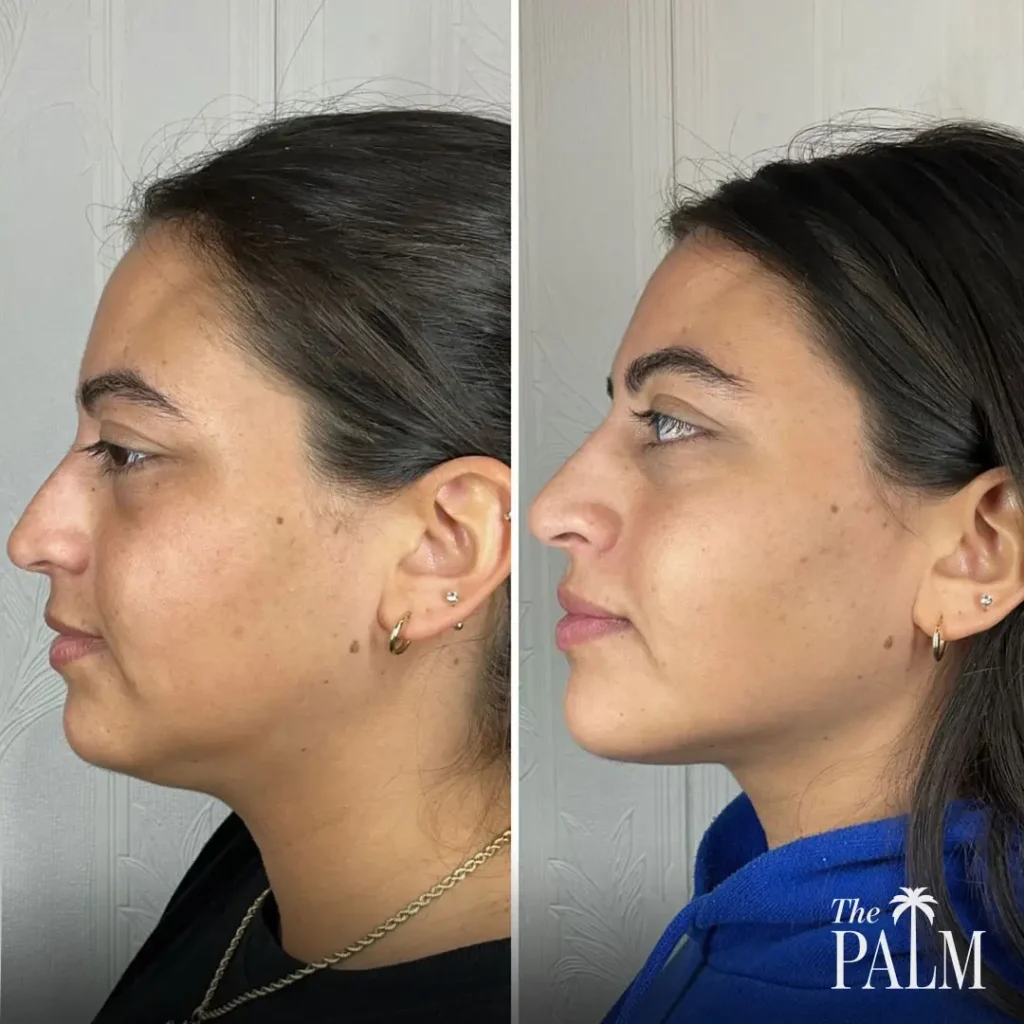 Facial Balancing