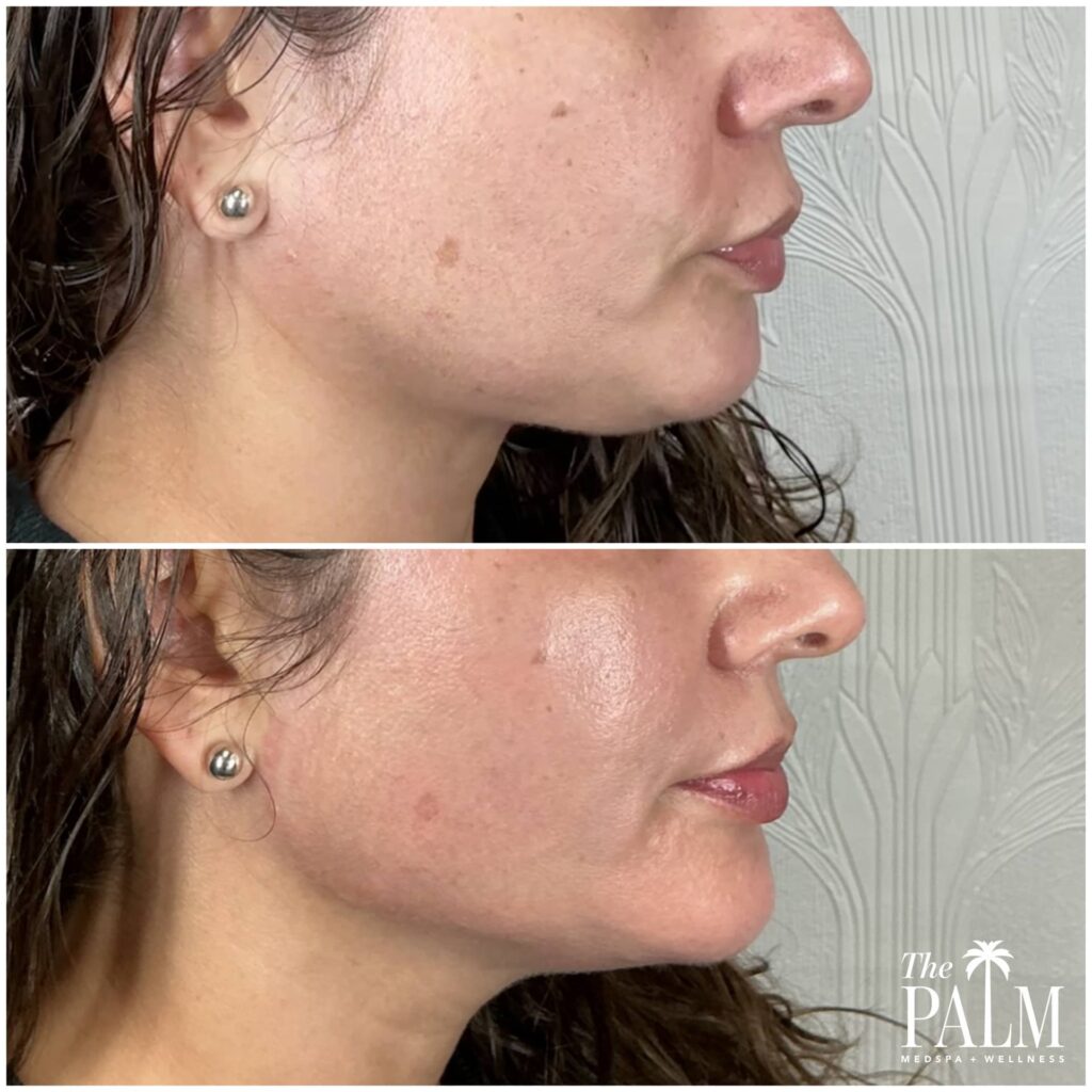 Facial Balancing