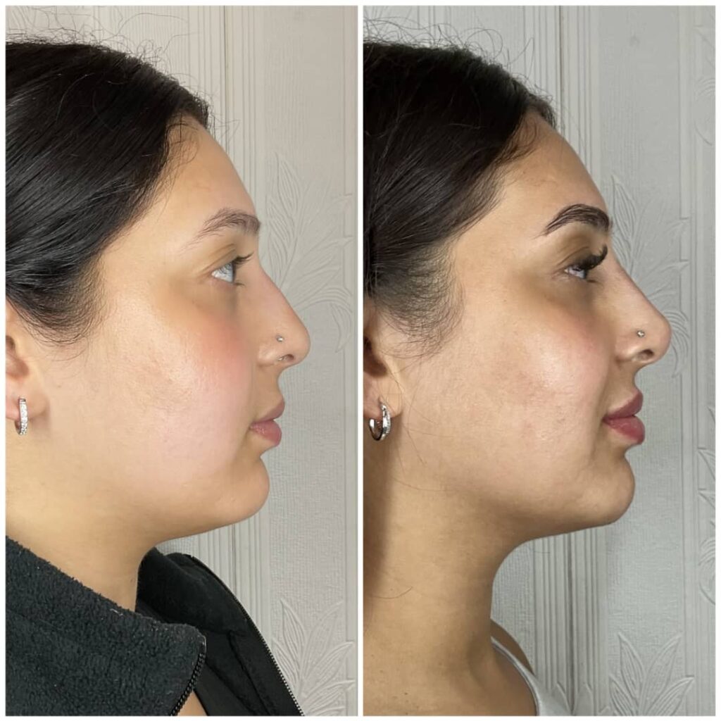 Facial Balancing