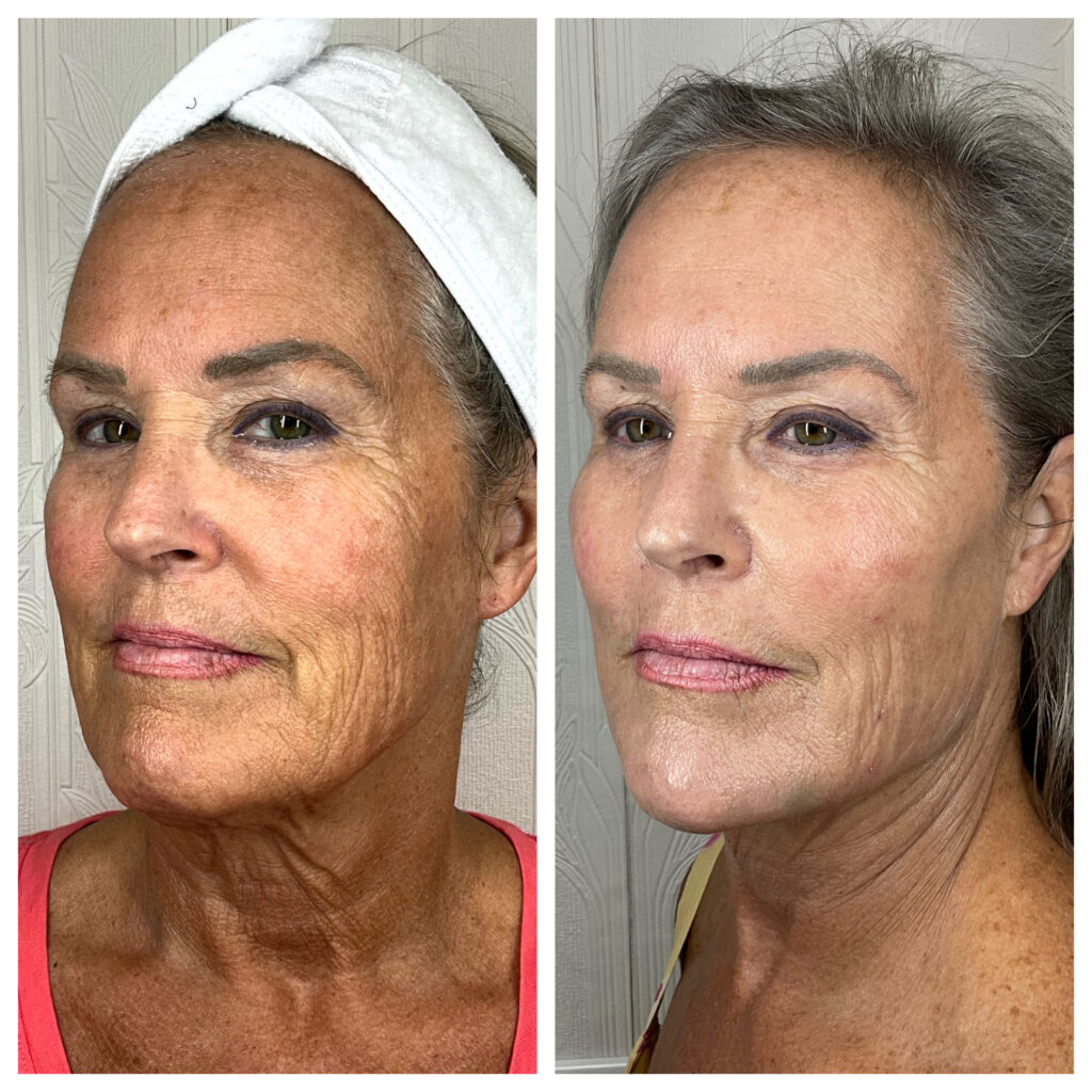 BBL HEROIC (sun damage repair)