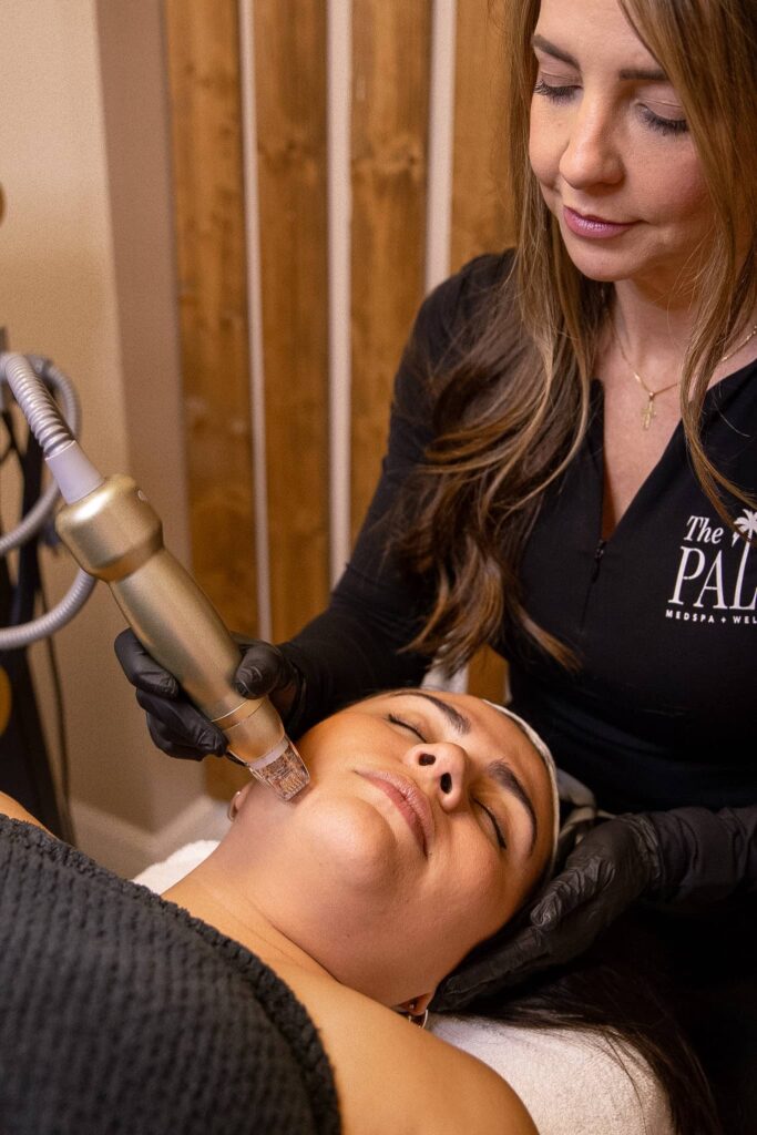Radio Frequency Microneedling